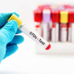 6 Nigerians Share Their Experience Getting STD Tests