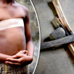 The Dangerous Breast Ironing Practice that Won’t Go Away