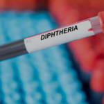 Diphtheria Outbreak: What You Need to Know