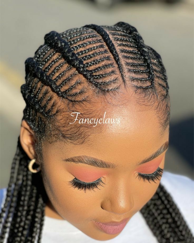 Stitch Cornrows with Feed-In Braids