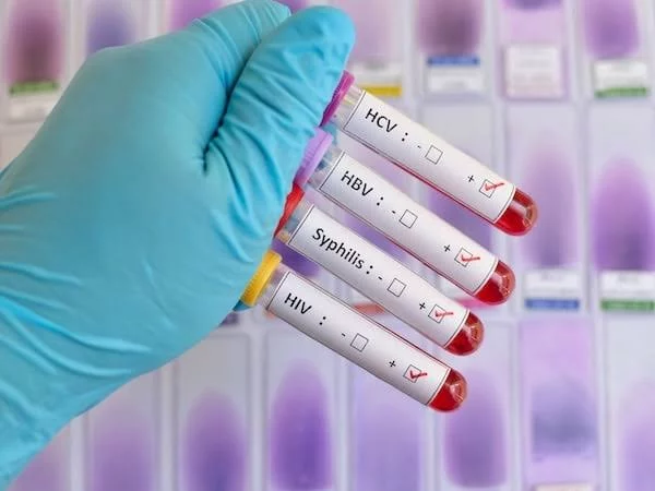 health test