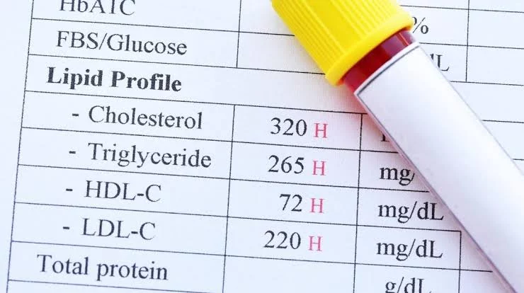 health tests